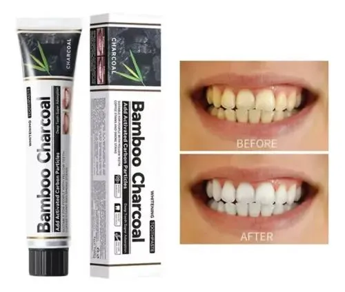 PASTA BLANQUEADORA DENTAL DE CARBON ACTIVADO BLUE CHIC