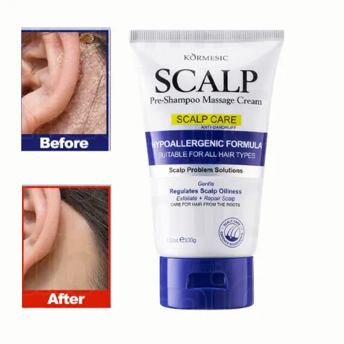 CREMA DE MASAJE CAPILAR ANTICASPA PARA TODO TIPO DE CABELLO KORMESIC 100G